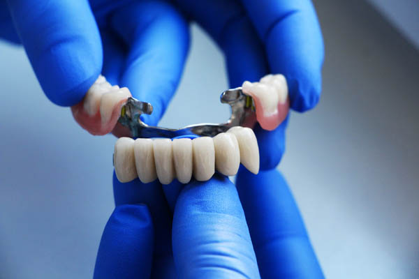 Tips For Dental Bridges Aftercare