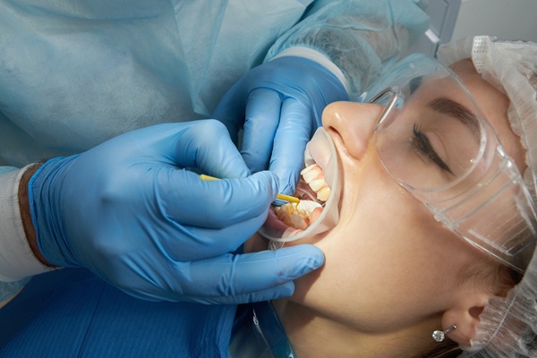 What To Ask Your Dentist About A Dental Cleaning