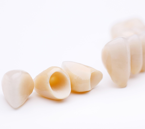 Jackson Dental Crowns and Dental Bridges