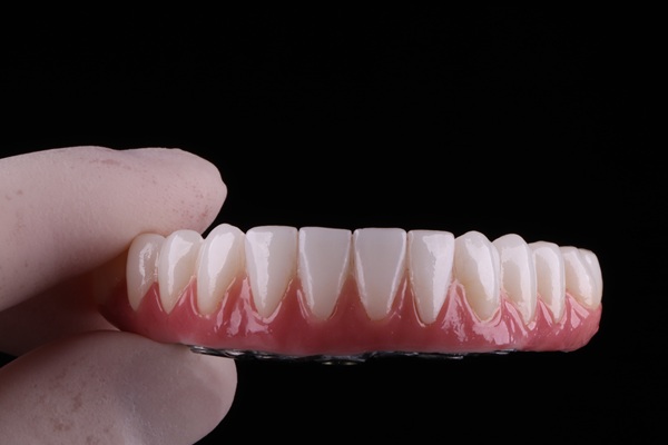 When To Consider Implant Supported Dentures Over Traditional Dentures