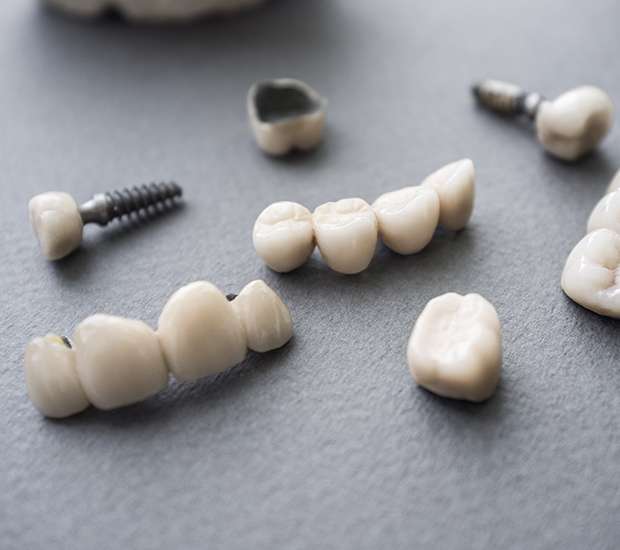 Jackson The Difference Between Dental Implants and Mini Dental Implants